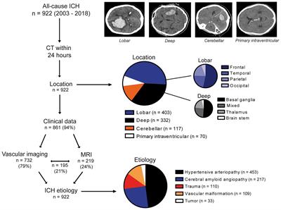 Risk factors for intracerebral hemorrhage in small-vessel disease and non-small-vessel disease etiologies—an observational proof-of-concept study